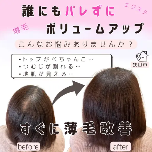 【ご新規様限定】すぐに薄毛改善❣️結び目が細かく誰にもバレない増毛エクステ300本!シャンプーやカラー普段通り生活OK!