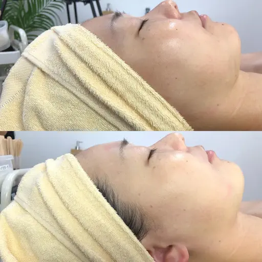 スキンケアフェイシャルWAX+スペシャルHARIパック