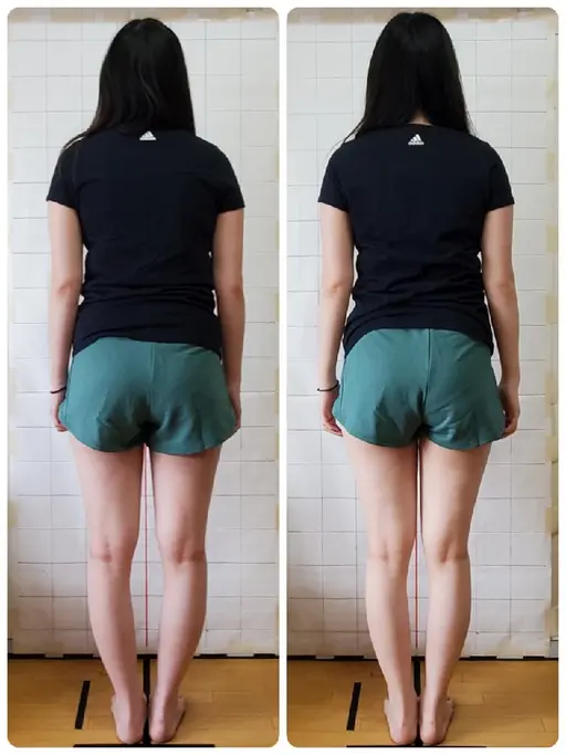 お試し美容整骨