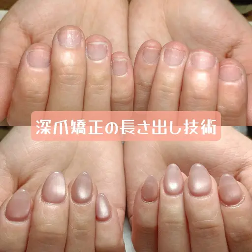 美爪へ変わる深爪矯正【長さ出し】上質カラー＋極上ケア＆保湿オイル贈呈