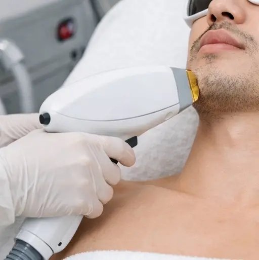 [ミニモ学割U24]メンズ顔高速光脱毛　ヒゲ・頬・口周りなど顔全体の産毛やムダ毛をケアし、自己処理による肌荒れ軽減。