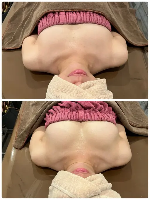 【毎月2名限定】骨格から根本改善！バストアップ＋美背中♡上半身もスッキリ✨夏に向けて自信が持てる上半身へ♡