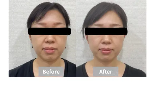 【小顔/むくみ/左右差】フェイスライン集中ケア60分 ¥2,980