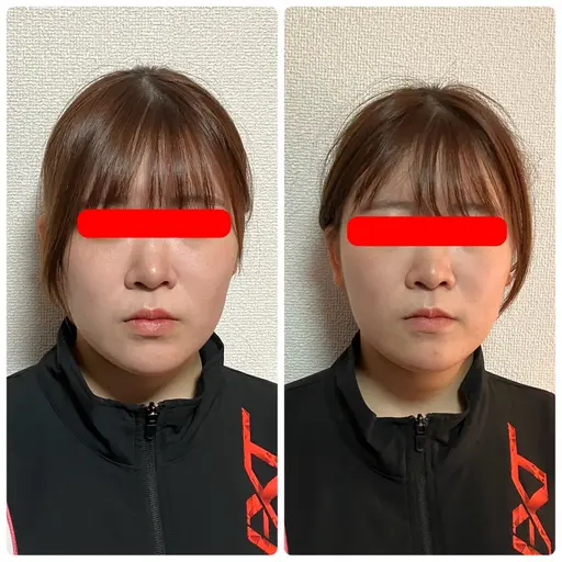 「ミニモ学割」小顔コース（90分）