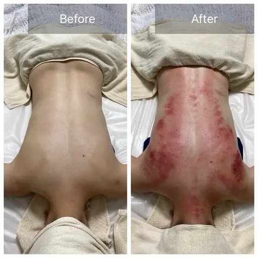 【肩こり/慢性疲労/背中のコリ/むくみ】ガチガチ背中カッサ+背中コルギ40分