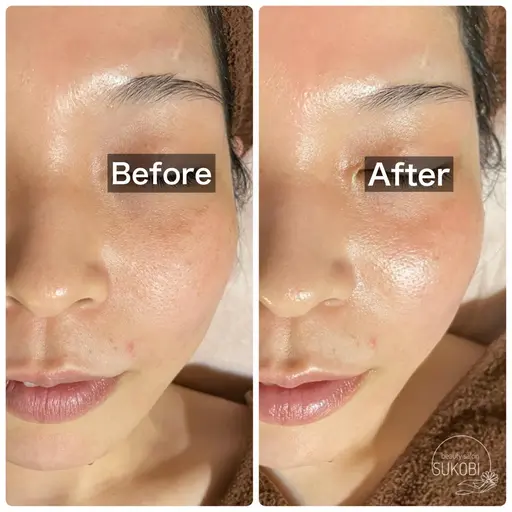 夏専用シーズナルエステ(デコルテ＋フェイシャルのオールハンド)小顔＋透明感＋美白！！(90分)