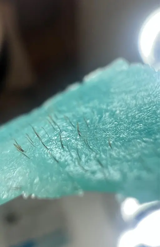 【産毛＆角質ケア🌱】艶肌×フェイシャル脱毛WAX(全顔)