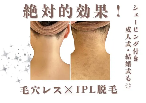 【🐼新生活☁️】U24/うなじ脱毛完全シェービング付🤍🫧形の相談からお任せ下さい🫶