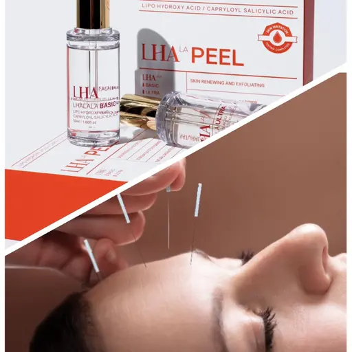 🌟人気No. 1🌟【美容鍼+ララピール】90分コース