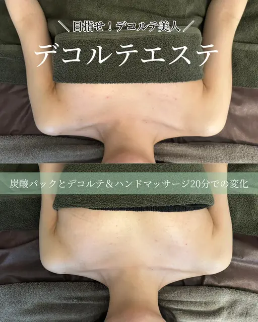 デコルテエステ40分