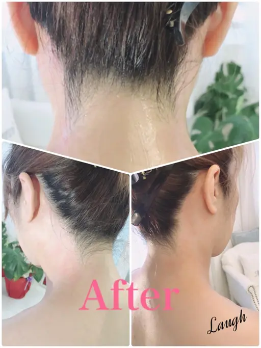 女性☆うなじwax脱毛☆モニター　※4/2より価格変更致します。1000→1500