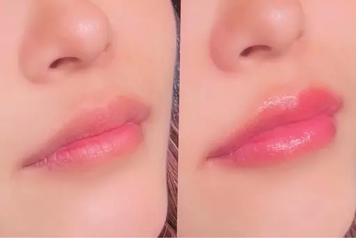 メラニンケア⭐️LALA PINKモニター(リップ)