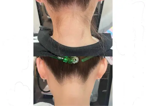 【3・4月限定/デビュー記念】特別価格☆うなじ脱毛￥2,860