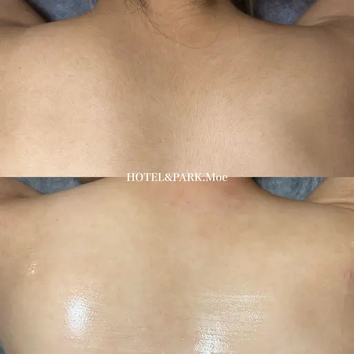 4/15~17限定☀️【背中上うなじ込ワックス脱毛】