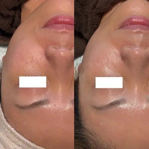 残り8名様‼️ハリ•弾力復活マスク✨コラーゲンマスク💆‍♀️