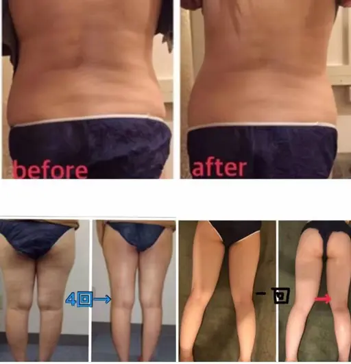 🌈大人気キャビテーション全身かけ放題🌈+筋膜リンパマッサージ+ヘッドスパ120分