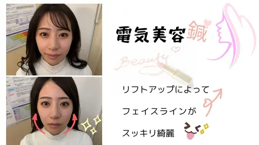 ❤️美容鍼1,500円クーポン❤️