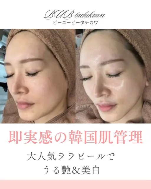 ⭐️本日限定⭐️来店の方全員にパックプレゼント❣️一回の施術でツヤ肌&美白に！話題のララピール🫧🍑