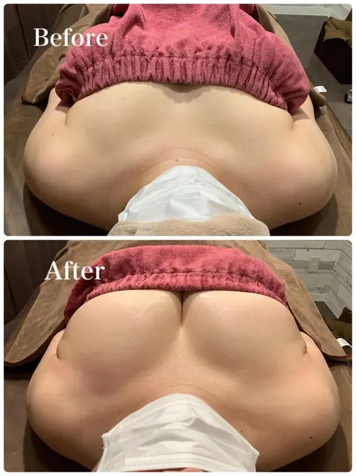 【ミニモ限定価格！1日1名限定】左右差離れ胸撃退！ふわふわっお椀型バスト💗　通常35000円→5800円