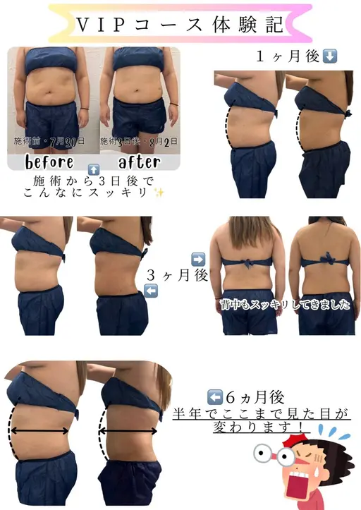 人気No,1✨️冷感スリムケア❄️部分集中ケア✨️