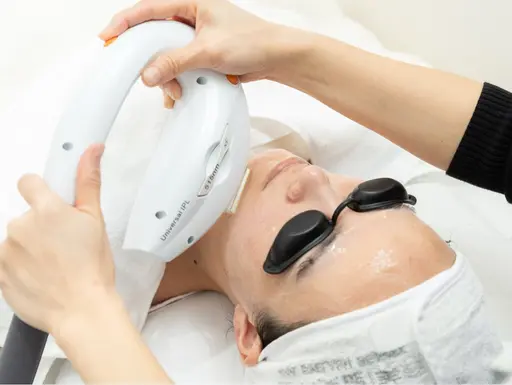 【赤み・シミ改善・ニキビケア】光フェイシャル