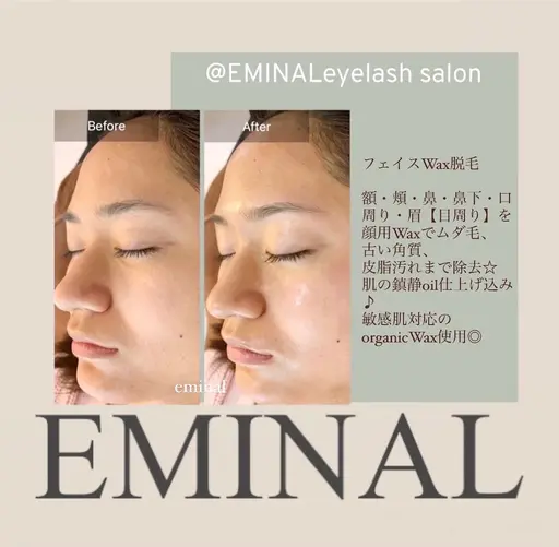 フェイシャルWAX脱毛