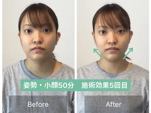 【アンケート特別価格】顔の歪み左右差&小顔矯正+姿勢矯正【50分17900→0】※先着3名