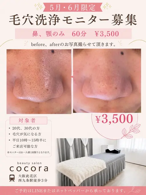 毛穴洗浄（鼻、あご）60分　¥3500
