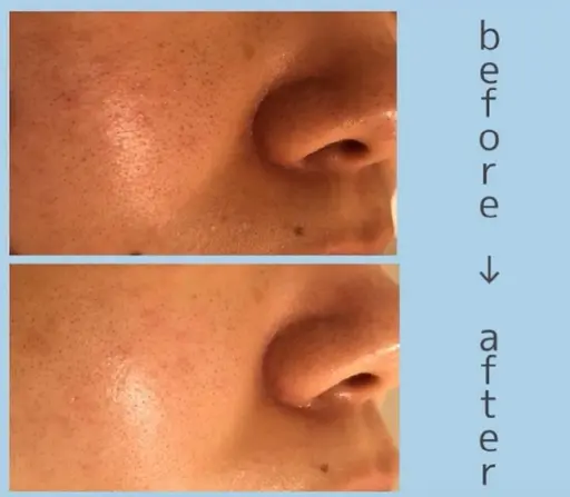 4月末まで【春限定セール🉐半額‼️】本格エステをエステモデル価格体験!!特別価格で💡肌分析付き‼️💁