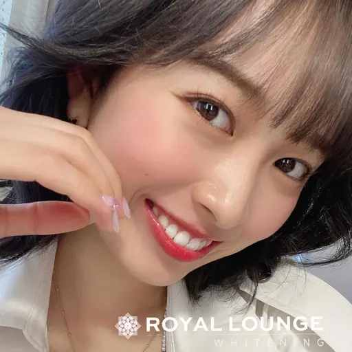 【一日1名限定】ミニモ口コミご協力ナチュラルホワイトニング25分✨