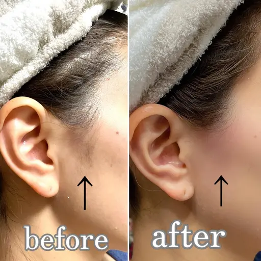 パーツwax(1パーツ)おでこ、もみあげ、鼻、鼻下、頬、あご(フェイスライン含む)