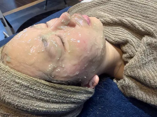 スペシャルケア🌿🫧毛穴洗浄➕剥離なし国産ハーブピーリング➕炭酸ガスハーブパック