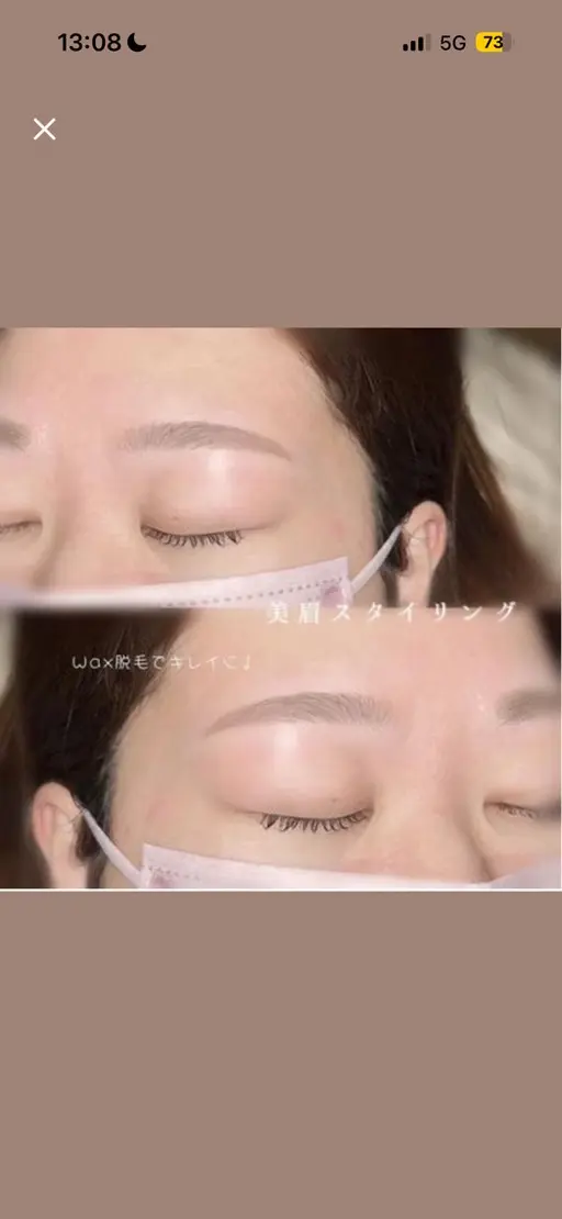 美眉ワックス脱毛