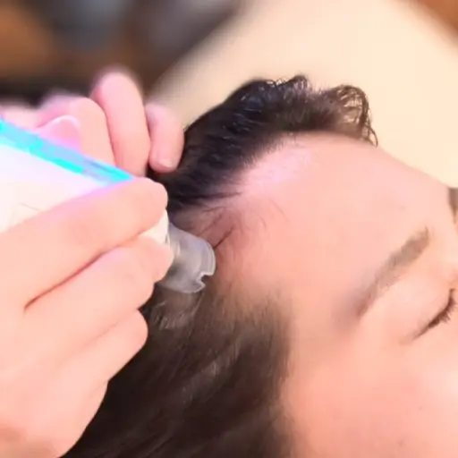 【1番人気★小顔】"頭皮からグッと引き上げ！スッキリ小顔実感リフトアップケア