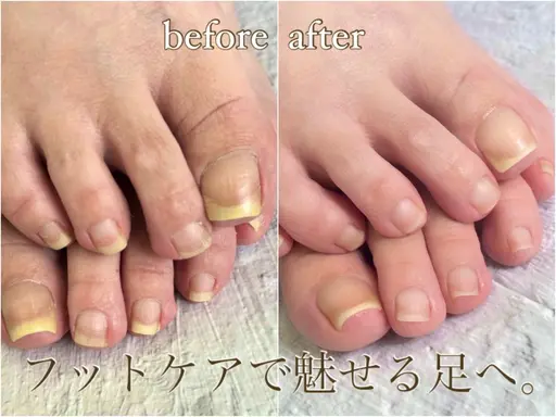 【オフ有可能】フット角質ケアコース(120分程度)