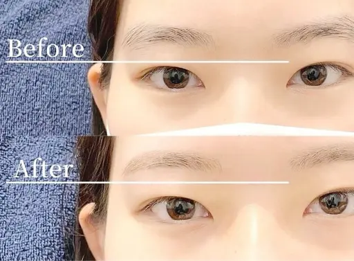 美眉スタイリング ワックス脱毛