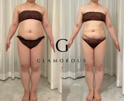 熊本|何しても痩せない女性専用本気の体質改善ダイエット体験