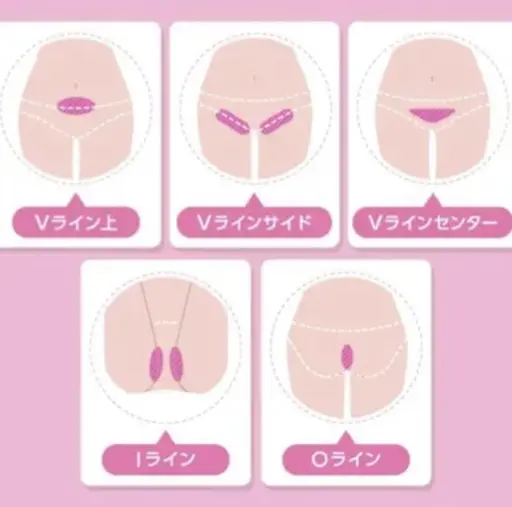 ⛄️VIO美肌脱毛⛄️冷却機能・デザイン自由👌本気で毛をなくしたい方必見💍目指せ自己処理いらず肌🌟