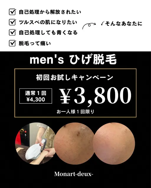 men's ひげ脱毛