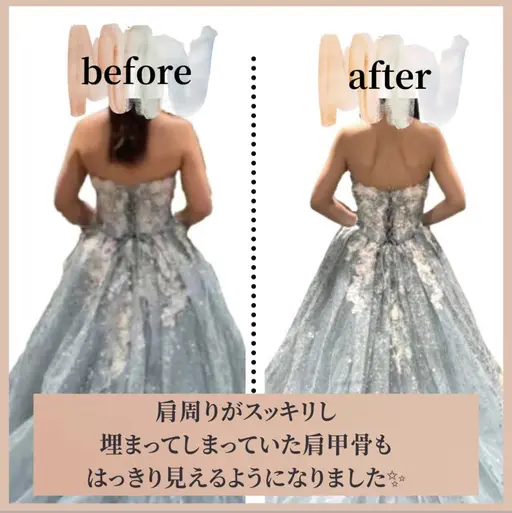 <Aお試し&相談>[10kg減量まで¥66,000～]目標体重まで通い放題コース&3年補償★180分