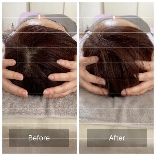 今話題の脳洗浄🌈頭の浮腫を取り除きます!下記料金は通常料金です。モニター価格にて予約の受付開始しております✨