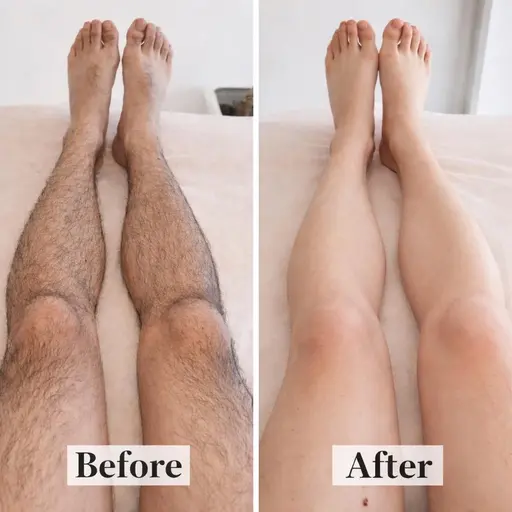 ⚡️4月限定⚡️新規様 【剃ってもすぐ生えるを卒業😳✨】 全身ツルスベ肌へ💖全身脱毛（顔・VIO込） 4,980円