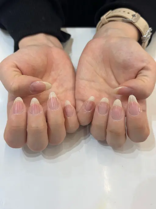 💜スカルプオフ💜