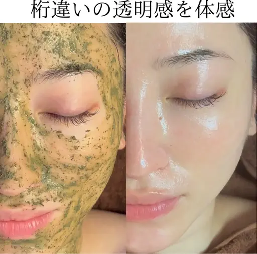 【リピ率No.1】ハーブピーリングで肌質改善＋専用美容液導入