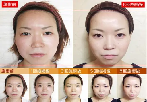 【小顔特化/リフトアップ/歪み改善】小顔整体コルギ+小顔矯正 ¥7,600→¥2,900