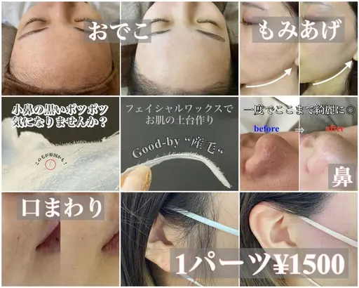 フェイシャル部分ワックス【2パーツ 3000円​〜​】(口周り、もみあげ、おでこ、鼻)