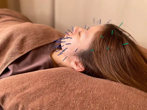 🉐【初回限定】ヒト幹細胞美容鍼