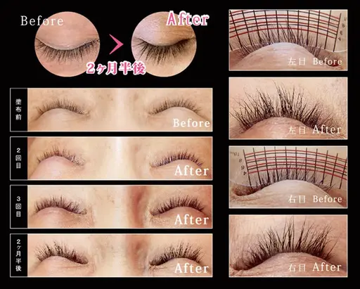 まつ毛育毛＊ラッシュアディクト