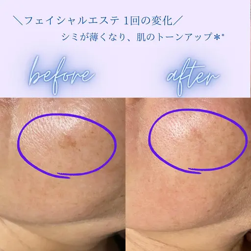 《潤いとトーンアップ✨》フェイシャルエステ