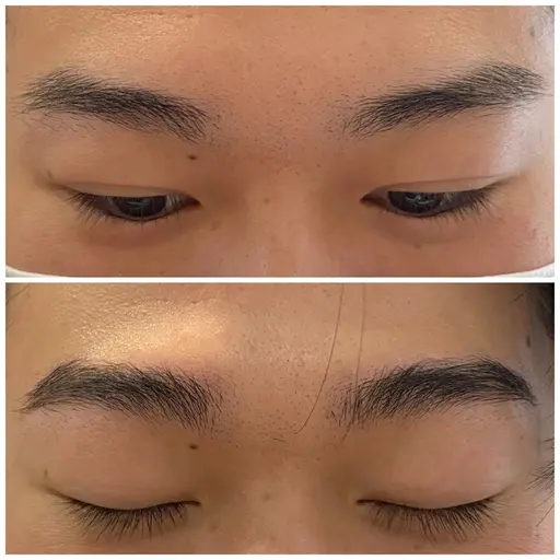 ナチュラルブロウリフト&シート脱毛